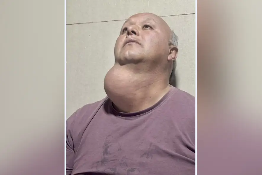 La familia de Ariel Melgarejo, pide ayuda tras 15 años esperando operación en Temuco